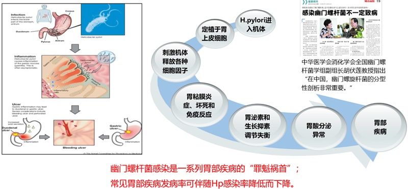 幽门螺杆菌（Hp）抗体分型检测